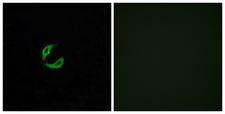 OR2K2 Antibody - Immunofluorescence analysis of A549 cells, using OR2K2 Antibody. The picture on the right is blocked with the synthesized peptide.