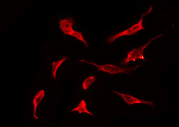 OR2K2 Antibody - Staining HT29 cells by IF/ICC. The samples were fixed with PFA and permeabilized in 0.1% Triton X-100, then blocked in 10% serum for 45 min at 25°C. The primary antibody was diluted at 1:200 and incubated with the sample for 1 hour at 37°C. An Alexa Fluor 594 conjugated goat anti-rabbit IgG (H+L) Ab, diluted at 1/600, was used as the secondary antibody.
