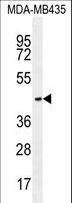 OR2L13 Antibody - OR2L13 Antibody western blot of MDA-MB435 cell line lysates (35 ug/lane). The OR2L13 antibody detected the OR2L13 protein (arrow).
