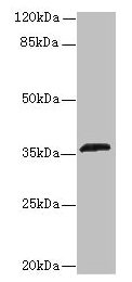 OR2L13 Antibody - Western blot All lanes: OR2L13 antibody at 6µg/ml + Mouse liver tissue Secondary Goat polyclonal to rabbit IgG at 1/10000 dilution Predicted band size: 36 kDa Observed band size: 36 kDa