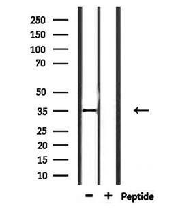 OR2L2 Antibody - Western blot analysis of extracts of rat brain tissue using OR2L2 antibody.