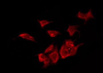OR2L5 Antibody - Staining COLO205 cells by IF/ICC. The samples were fixed with PFA and permeabilized in 0.1% Triton X-100, then blocked in 10% serum for 45 min at 25°C. The primary antibody was diluted at 1:200 and incubated with the sample for 1 hour at 37°C. An Alexa Fluor 594 conjugated goat anti-rabbit IgG (H+L) Ab, diluted at 1/600, was used as the secondary antibody.