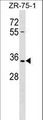 OR2L8 Antibody - OR2L8 Antibody western blot of ZR-75-1 cell line lysates (35 ug/lane). The OR2L8 antibody detected the OR2L8 protein (arrow).