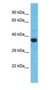 OR2M2 Antibody - OR2M2 antibody Western Blot of Jurkat. Antibody dilution: 1 ug/ml.  This image was taken for the unconjugated form of this product. Other forms have not been tested.