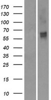 OR2M2 Protein - Western validation with an anti-DDK antibody * L: Control HEK293 lysate R: Over-expression lysate