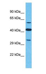 OR2M4 Antibody - OR2M4 antibody Western Blot of Jurkat. Antibody dilution: 1 ug/ml.  This image was taken for the unconjugated form of this product. Other forms have not been tested.