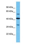 OR2M4 Antibody - OR2M4 antibody Western Blot of Jurkat. Antibody dilution: 1 ug/ml.  This image was taken for the unconjugated form of this product. Other forms have not been tested.