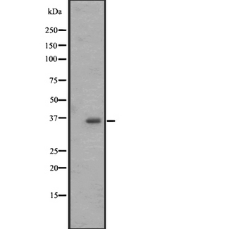 OR2M4 Antibody - Western blot analysis of OR2M4 expression in Jurkat whole cells lysate. The lane on the left is treated with the antigen-specific peptide.