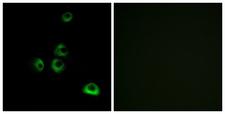 OR2M5 Antibody - Immunofluorescence analysis of MCF7 cells, using OR2M7 Antibody. The picture on the right is blocked with the synthesized peptide.