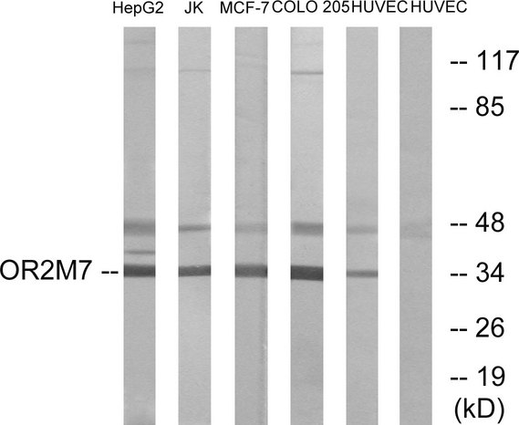 OR2M5 Antibody - Western blot analysis of lysates from HUVEC, COLO, MCF-7, Jurkat, and HepG2 cells, using OR2M7 Antibody. The lane on the right is blocked with the synthesized peptide.