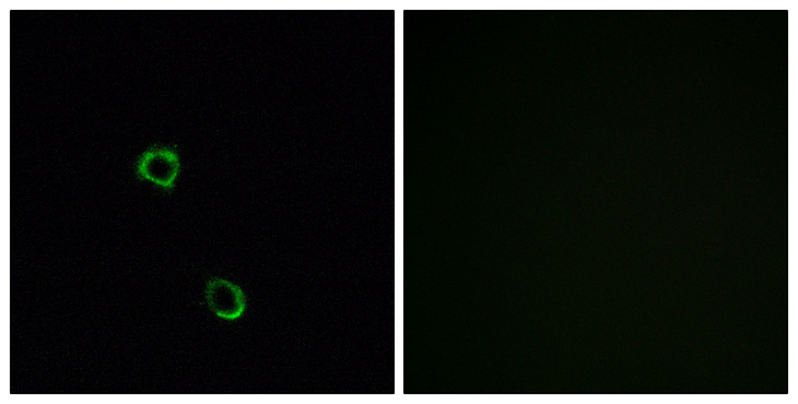 OR2M5 Antibody - Immunofluorescence analysis of MCF7 cells, using OR2M2 Antibody. The picture on the right is blocked with the synthesized peptide.