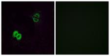 OR2T1 Antibody - Immunofluorescence analysis of A549 cells, using OR2T1 Antibody. The picture on the right is blocked with the synthesized peptide.