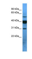 OR2T1 Antibody - OR2T1 antibody Western blot of MCF7 cell lysate. This image was taken for the unconjugated form of this product. Other forms have not been tested.