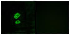 OR2T10 Antibody - Immunofluorescence analysis of MCF7 cells, using OR2T10 Antibody. The picture on the right is blocked with the synthesized peptide.