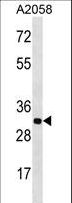 OR2T11 Antibody - OR2T11 Antibody western blot of A2058 cell line lysates (35 ug/lane). The OR2T11 antibody detected the OR2T11 protein (arrow).