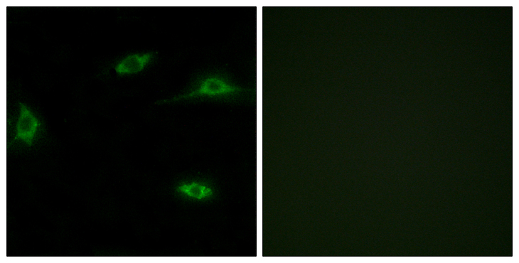 OR2T11 Antibody - Immunofluorescence analysis of LOVO cells, using OR2T11 Antibody. The picture on the right is blocked with the synthesized peptide.