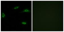 OR2T11 Antibody - Immunofluorescence analysis of LOVO cells, using OR2T11 Antibody. The picture on the right is blocked with the synthesized peptide.