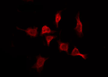 OR2T11 Antibody - Staining MCF-7 cells by IF/ICC. The samples were fixed with PFA and permeabilized in 0.1% Triton X-100, then blocked in 10% serum for 45 min at 25°C. The primary antibody was diluted at 1:200 and incubated with the sample for 1 hour at 37°C. An Alexa Fluor 594 conjugated goat anti-rabbit IgG (H+L) Ab, diluted at 1/600, was used as the secondary antibody.