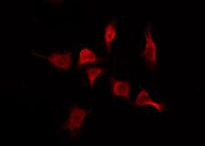 OR2T11 Antibody - Staining MCF-7 cells by IF/ICC. The samples were fixed with PFA and permeabilized in 0.1% Triton X-100, then blocked in 10% serum for 45 min at 25°C. The primary antibody was diluted at 1:200 and incubated with the sample for 1 hour at 37°C. An Alexa Fluor 594 conjugated goat anti-rabbit IgG (H+L) Ab, diluted at 1/600, was used as the secondary antibody.