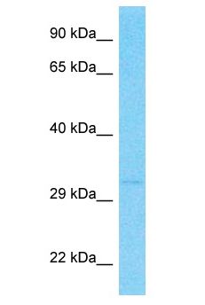 OR2T12 Antibody - OR2T12 antibody Western Blot of MCF7. Antibody dilution: 1 ug/ml.  This image was taken for the unconjugated form of this product. Other forms have not been tested.