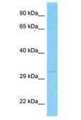 OR2T12 Antibody - OR2T12 antibody Western Blot of MCF7. Antibody dilution: 1 ug/ml.  This image was taken for the unconjugated form of this product. Other forms have not been tested.