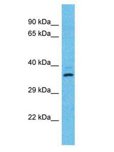 OR2T12 Antibody - OR2T12 antibody Western Blot of HT1080. Antibody dilution: 1 ug/ml.  This image was taken for the unconjugated form of this product. Other forms have not been tested.