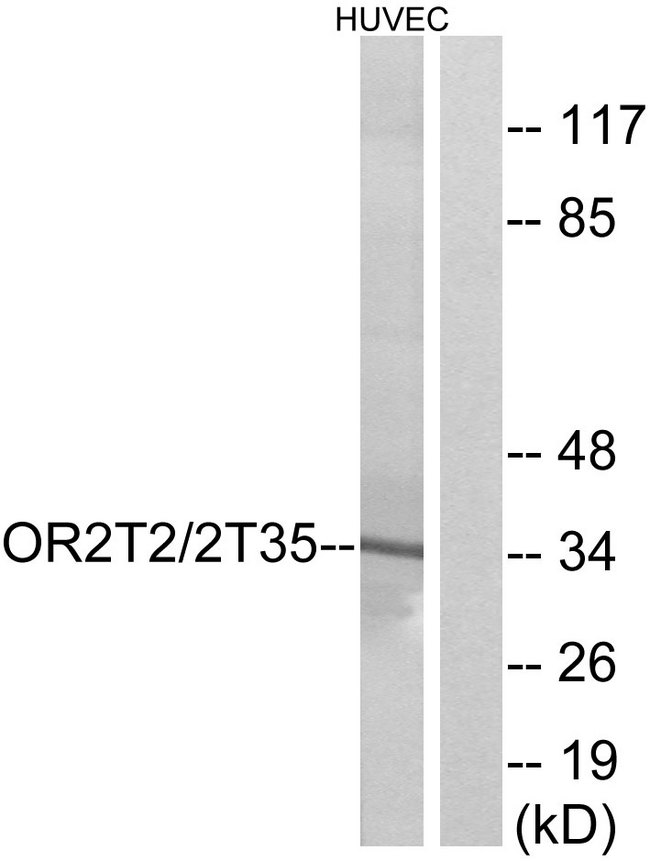 OR2T2 + OR2T35 Antibody - Western blot analysis of lysates from HUVEC cells, using OR2T2/2T35 Antibody. The lane on the right is blocked with the synthesized peptide.