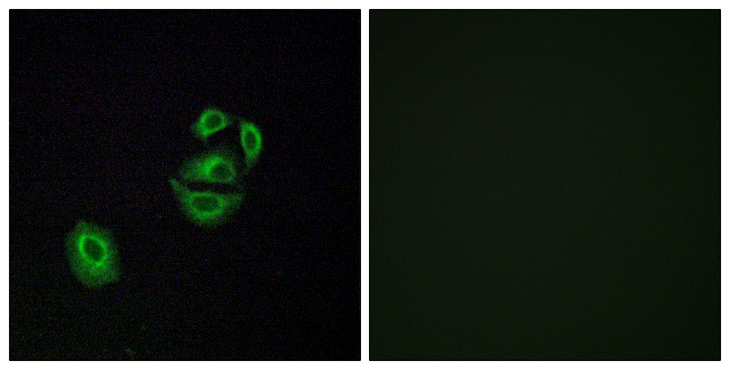 OR2T2 + OR2T35 Antibody - Immunofluorescence analysis of A549 cells, using OR2T2/2T35 Antibody. The picture on the right is blocked with the synthesized peptide.