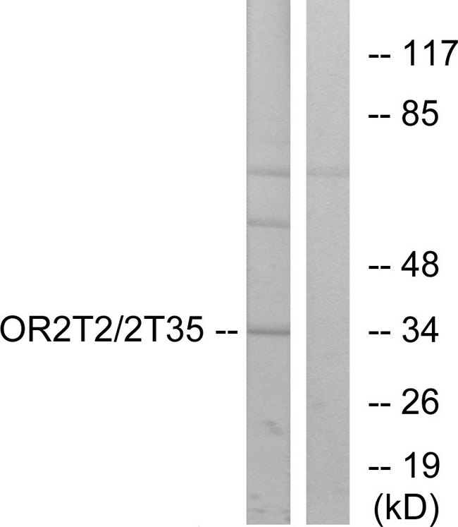 OR2T2 + OR2T35 Antibody - Western blot analysis of lysates from HepG2 cells, using OR2T2/2T35 Antibody. The lane on the right is blocked with the synthesized peptide.