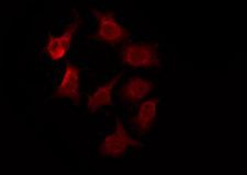 OR2T2 + OR2T35 Antibody - Staining HuvEc cells by IF/ICC. The samples were fixed with PFA and permeabilized in 0.1% Triton X-100, then blocked in 10% serum for 45 min at 25°C. The primary antibody was diluted at 1:200 and incubated with the sample for 1 hour at 37°C. An Alexa Fluor 594 conjugated goat anti-rabbit IgG (H+L) Ab, diluted at 1/600, was used as the secondary antibody.