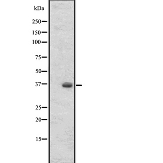 OR2T27 Antibody - Western blot analysis of OR2T27 expression in 293 cells line lysates. The lane on the left is treated with the antigen-specific peptide.