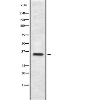 OR2T3 + OR2T34 Antibody - Western blot analysis OR2T3/34 using HeLa whole cells lysates