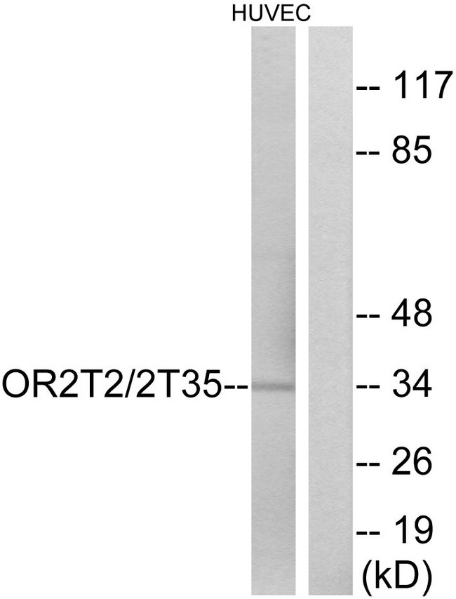 OR2T35 Antibody - Western blot analysis of lysates from HUVEC cells, using OR2T2/2T35 Antibody. The lane on the right is blocked with the synthesized peptide.