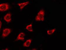 OR2T5+29 Antibody - Staining HeLa cells by IF/ICC. The samples were fixed with PFA and permeabilized in 0.1% Triton X-100, then blocked in 10% serum for 45 min at 25°C. The primary antibody was diluted at 1:200 and incubated with the sample for 1 hour at 37°C. An Alexa Fluor 594 conjugated goat anti-rabbit IgG (H+L) Ab, diluted at 1/600, was used as the secondary antibody.