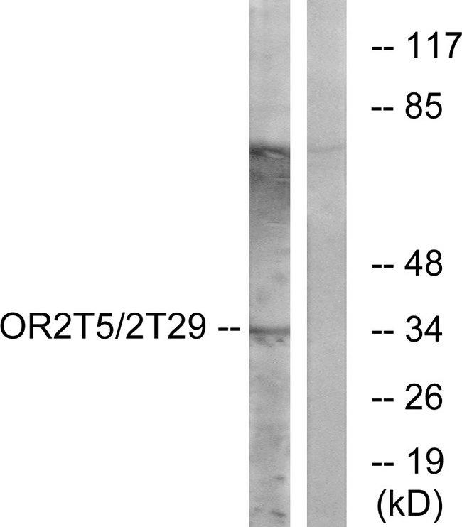 OR2T5+29 Antibody - Western blot analysis of extracts from K562 cells, using OR2T5/2T29 antibody.
