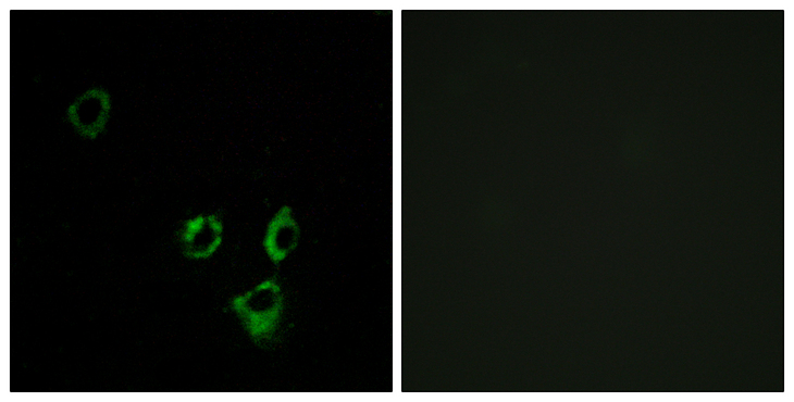 OR2T5 Antibody - Immunofluorescence analysis of MCF7 cells, using OR2T5/2T29 Antibody. The picture on the right is blocked with the synthesized peptide.