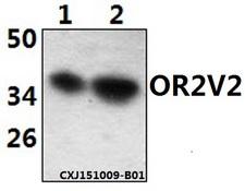OR2V2 Antibody - Western blot of OR2V2 polyclonal antibody at 1:500 dilution. Lane 1: HeLa whole cell lysate (40 ug). Lane 2: Jurkat whole cell lysate (40 ug).