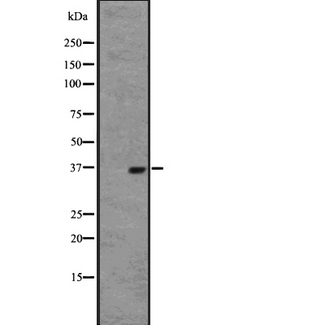OR2W1 Antibody - human normal uterus tissue lysate; developed using the ECL technique