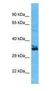 OR2W3 Antibody - OR2W3 antibody Western Blot of HeLa. Antibody dilution: 1 ug/ml.  This image was taken for the unconjugated form of this product. Other forms have not been tested.