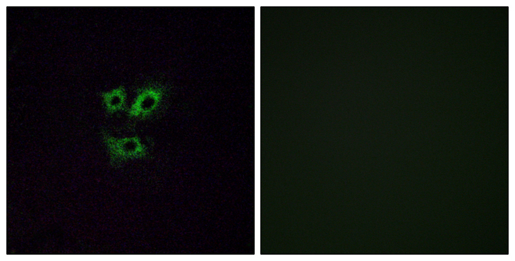 OR2Y1 Antibody - Immunofluorescence analysis of A549 cells, using OR2Y1 Antibody. The picture on the right is blocked with the synthesized peptide.