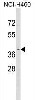 OR2Y1 Antibody - OR2Y1 Antibody western blot of NCI-H460 cell line lysates (35 ug/lane). The OR2Y1 antibody detected the OR2Y1 protein (arrow).