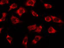 OR3A2+3 Antibody - Staining MCF-7 cells by IF/ICC. The samples were fixed with PFA and permeabilized in 0.1% Triton X-100, then blocked in 10% serum for 45 min at 25°C. The primary antibody was diluted at 1:200 and incubated with the sample for 1 hour at 37°C. An Alexa Fluor 594 conjugated goat anti-rabbit IgG (H+L) Ab, diluted at 1/600, was used as the secondary antibody.