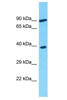 OR3A2 Antibody - OR3A2 antibody Western Blot of COLO205. Antibody dilution: 1 ug/ml.  This image was taken for the unconjugated form of this product. Other forms have not been tested.