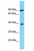 OR3A2 Antibody - OR3A2 antibody Western Blot of COLO205. Antibody dilution: 1 ug/ml.  This image was taken for the unconjugated form of this product. Other forms have not been tested.