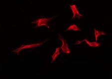 OR3A2 Antibody - Staining HeLa cells by IF/ICC. The samples were fixed with PFA and permeabilized in 0.1% Triton X-100, then blocked in 10% serum for 45 min at 25°C. The primary antibody was diluted at 1:200 and incubated with the sample for 1 hour at 37°C. An Alexa Fluor 594 conjugated goat anti-rabbit IgG (H+L) Ab, diluted at 1/600, was used as the secondary antibody.