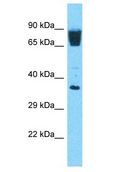 OR3A3 Antibody - OR3A3 antibody Western Blot of 293T. Antibody dilution: 1 ug/ml.  This image was taken for the unconjugated form of this product. Other forms have not been tested.