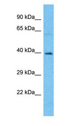 OR4A15 Antibody - OR4A15 antibody Western Blot of HepG2. Antibody dilution: 1 ug/ml.  This image was taken for the unconjugated form of this product. Other forms have not been tested.