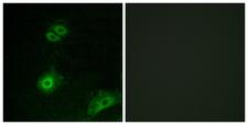 OR4A16 Antibody - Immunofluorescence analysis of A549 cells, using OR4A16 Antibody. The picture on the right is blocked with the synthesized peptide.