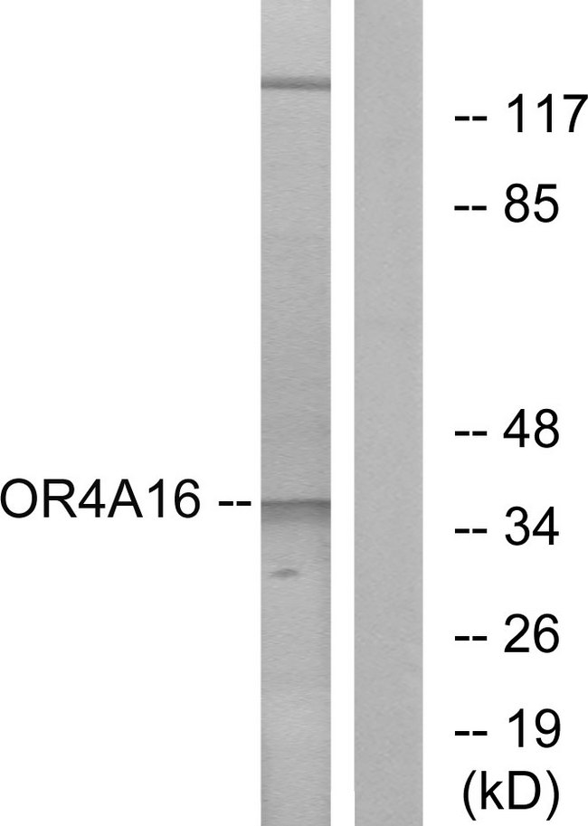 OR4A16 Antibody - Western blot analysis of lysates from COLO cells, using OR4A16 Antibody. The lane on the right is blocked with the synthesized peptide.