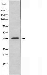 OR4A16 Antibody - Western blot analysis of extracts of COLO cells using OR4A16 antibody.